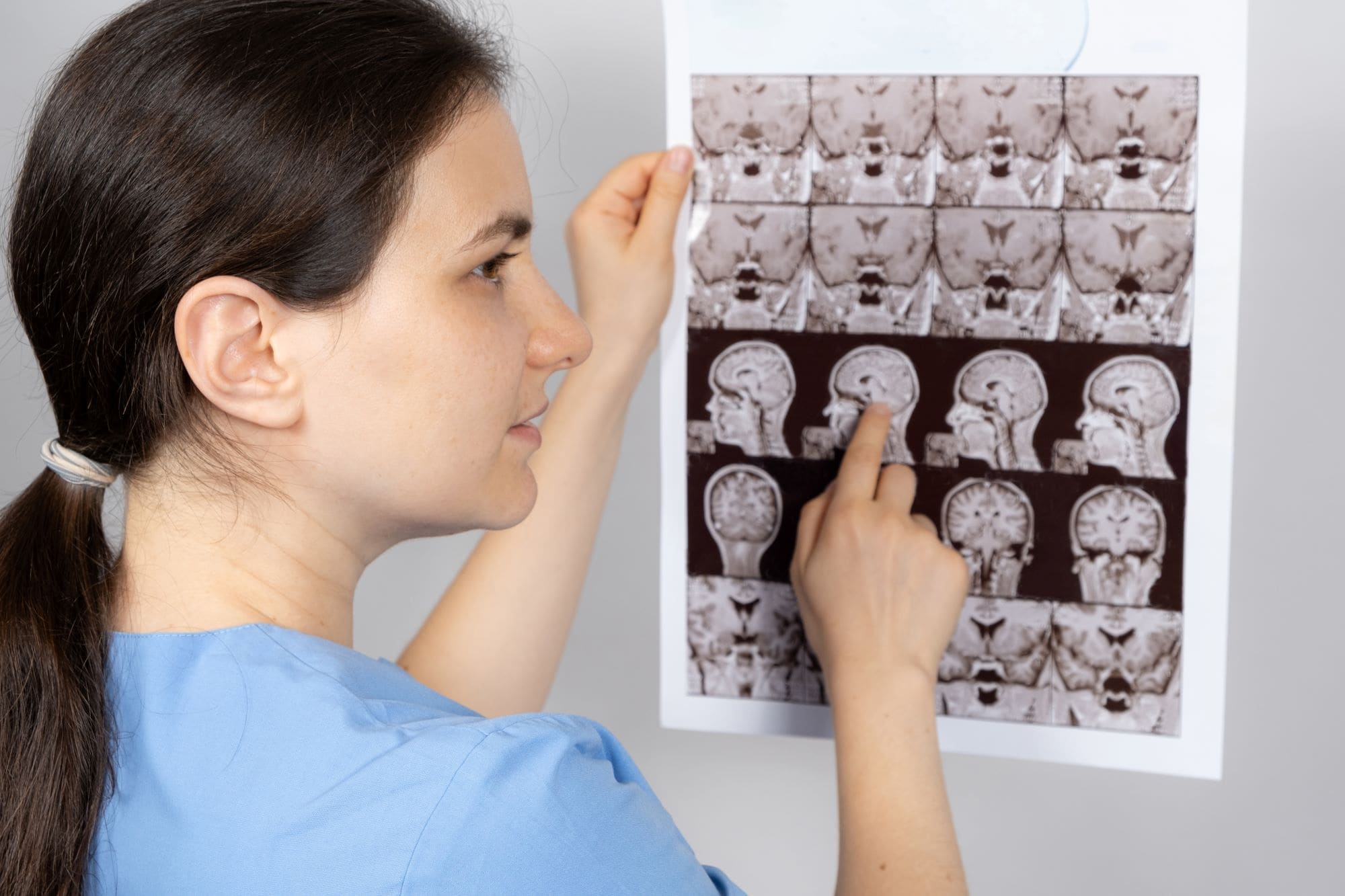 Tumores de hipófisis se pueden extirpar por la nariz mediante una endoscopia endonasal 1 tumor hipofisis baja1