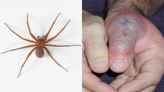 aranapicadura