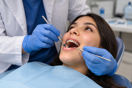 Brackets sin tratar caries dañan salud bucal 1 Brackets Peru 21