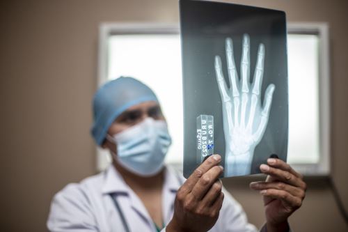 Causas de la osteoporosis y cómo prevenir fracturas 1 Foto medico osteoporosis
